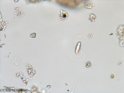 phyto/Bizerte/bizerte_lagoon/RISCO February 2015/Entomoneis alata (ancien Lagune_T1-B_Entomoneis alata -3).tif(copy)_thumb.jpg